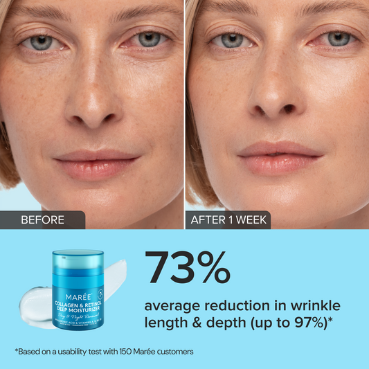 Retinol & Collagen Anti-Age Cream - Rollexi